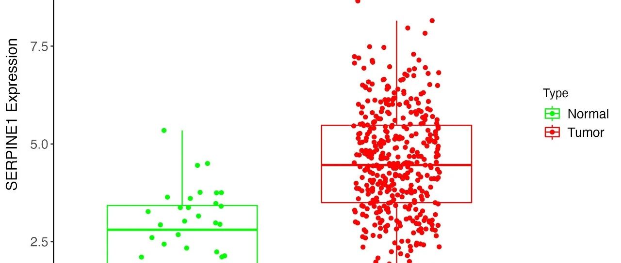 TCGA数据挖掘(1)：单基因表达差异分享