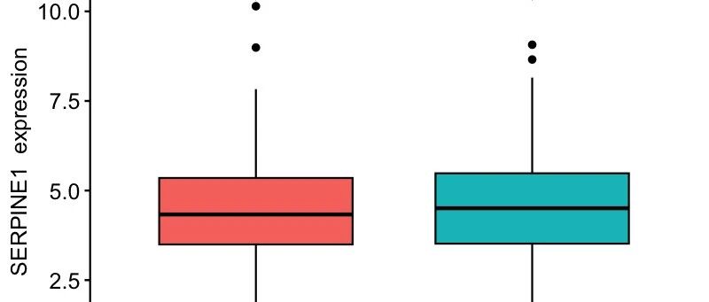 TCGA数据挖掘(5)：什么是临床相关性分析？如何关联单基因表达与患者临床特征