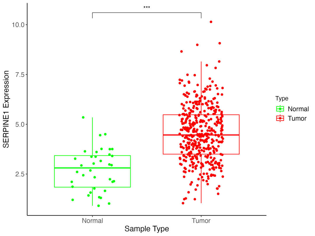 图1：SERPINE1 在肿瘤与癌旁组织中的表达差异